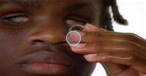 Blind Boy