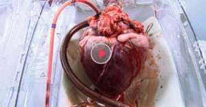 Heart Beating