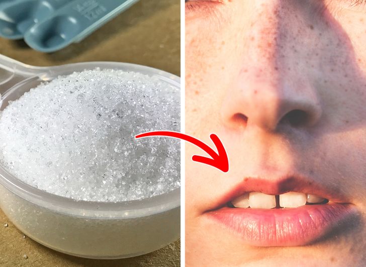 Easy Recipes For Getting Rid Of Facial Hair At Home