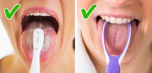 Dental Cleanliness Errors