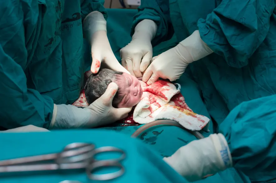 Facts About C-Sections
