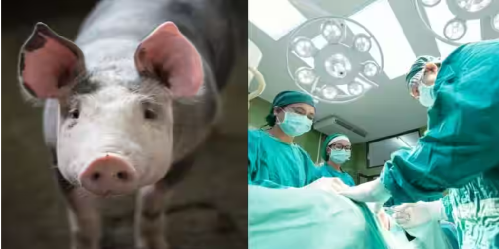 Pioneering Transplants